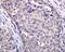 Valosin Containing Protein antibody, ab109240, Abcam, Immunohistochemistry paraffin image 