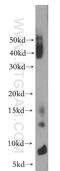 RNA Polymerase II Subunit J antibody, 16403-1-AP, Proteintech Group, Western Blot image 
