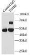Transforming Growth Factor Beta Induced antibody, FNab08642, FineTest, Immunoprecipitation image 