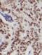 Protein Kinase D2 antibody, FNab06785, FineTest, Immunohistochemistry frozen image 