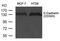 Cadherin 1 antibody, GTX50757, GeneTex, Western Blot image 