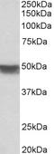 Keratin 20 antibody, EB11745, Everest Biotech, Western Blot image 
