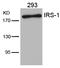 Insulin Receptor Substrate 1 antibody, A00268, Boster Biological Technology, Western Blot image 