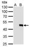 Interferon Lambda 3 antibody, GTX629699, GeneTex, Western Blot image 