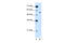 Solute Carrier Family 2 Member 10 antibody, 29-941, ProSci, Western Blot image 