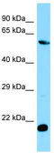 MOB Kinase Activator 1B antibody, TA338278, Origene, Western Blot image 