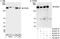 ERBB2 antibody, A300-623A, Bethyl Labs, Western Blot image 