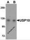 Ubiquitin Specific Peptidase 10 antibody, 5803, ProSci, Western Blot image 