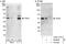 Tyrosyl-DNA Phosphodiesterase 2 antibody, A302-737A, Bethyl Labs, Western Blot image 