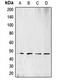 Branched Chain Keto Acid Dehydrogenase Kinase antibody, MBS820508, MyBioSource, Western Blot image 