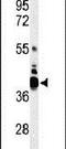 V-set domain-containing T-cell activation inhibitor 1 antibody, PA5-26803, Invitrogen Antibodies, Western Blot image 