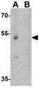 Serine/threonine-protein kinase PINK1, mitochondrial antibody, GTX31581, GeneTex, Western Blot image 