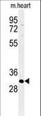 ATPase H+/K+ Transporting Subunit Beta antibody, LS-C156651, Lifespan Biosciences, Western Blot image 