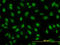 YY1 Transcription Factor antibody, LS-C133520, Lifespan Biosciences, Immunofluorescence image 