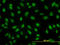 Transcriptional repressor protein YY1 antibody, LS-C133520, Lifespan Biosciences, Immunofluorescence image 