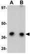 Cysteine And Histidine Rich Domain Containing 1 antibody, GTX85209, GeneTex, Western Blot image 