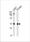 Guanine nucleotide-binding protein G(o) subunit alpha antibody, TA325095, Origene, Western Blot image 