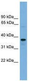 VPS16 Core Subunit Of CORVET And HOPS Complexes antibody, TA344640, Origene, Western Blot image 