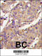 Ubiquitin Conjugating Enzyme E2 L6 antibody, 61-081, ProSci, Immunohistochemistry paraffin image 