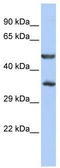 Zinc Finger Protein 414 antibody, TA345440, Origene, Western Blot image 