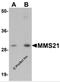 NSE2 (MMS21) Homolog, SMC5-SMC6 Complex SUMO Ligase antibody, 5759, ProSci, Western Blot image 