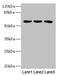 Phosphoinositide-3-Kinase Regulatory Subunit 3 antibody, LS-C676263, Lifespan Biosciences, Western Blot image 