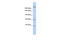 Kinesin Family Member 13B antibody, 25-169, ProSci, Western Blot image 