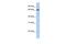 Zinc Finger Protein 136 antibody, PA5-41100, Invitrogen Antibodies, Western Blot image 