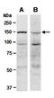 BRCA1/BRCA2-Containing Complex Subunit 3 antibody, orb66965, Biorbyt, Western Blot image 