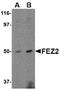 Fasciculation And Elongation Protein Zeta 2 antibody, TA306503, Origene, Western Blot image 