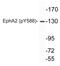 Ephrin type-A receptor 2 antibody, LS-C291496, Lifespan Biosciences, Western Blot image 