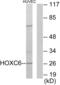 Homeobox C6 antibody, abx013371, Abbexa, Western Blot image 