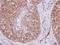 Exportin 6 antibody, GTX121149, GeneTex, Immunohistochemistry paraffin image 