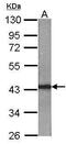 RAD51 Recombinase antibody, PA5-27195, Invitrogen Antibodies, Western Blot image 