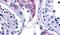 Estrogen Related Receptor Beta antibody, PA5-33522, Invitrogen Antibodies, Immunohistochemistry frozen image 