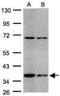 STIP1 Homology And U-Box Containing Protein 1 antibody, NBP1-30936, Novus Biologicals, Western Blot image 