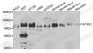 Ataxin 1 antibody, A6217, ABclonal Technology, Western Blot image 
