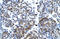 SPT5 Homolog, DSIF Elongation Factor Subunit antibody, 27-847, ProSci, Enzyme Linked Immunosorbent Assay image 