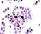 p53 antibody, PA5-17545, Invitrogen Antibodies, Immunohistochemistry paraffin image 