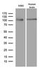 Argonaute RISC Component 1 antibody, LS-C798882, Lifespan Biosciences, Western Blot image 
