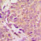 Unc-51 Like Kinase 3 antibody, LS-C358883, Lifespan Biosciences, Immunohistochemistry frozen image 