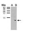Fc Fragment Of IgE Receptor Ig antibody, PA5-28832, Invitrogen Antibodies, Western Blot image 