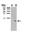 Fc Fragment Of IgE Receptor Ig antibody, PA5-28832, Invitrogen Antibodies, Western Blot image 