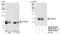 Protein Phosphatase 2 Regulatory Subunit B'Delta antibody, NB100-57538, Novus Biologicals, Western Blot image 
