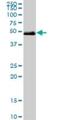 HNF1 Homeobox B antibody, H00006928-M01, Novus Biologicals, Western Blot image 