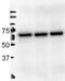 Albumin antibody, NB600-41532, Novus Biologicals, Western Blot image 