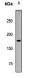 Dynein Light Chain LC8-Type 1 antibody, LS-C668144, Lifespan Biosciences, Western Blot image 