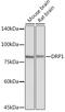 Dynamin 1 Like antibody, GTX54040, GeneTex, Western Blot image 