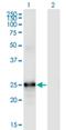 Fibroblast Growth Factor 19 antibody, H00009965-M01, Novus Biologicals, Western Blot image 