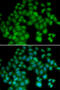 TYB4 antibody, 19-661, ProSci, Immunofluorescence image 